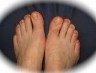Foot Health in Milton Keynes